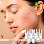 Acne Kit 7 Products By Nova Skin