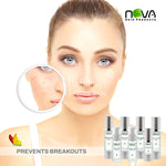 Acne Kit 7 Products By Nova Skin