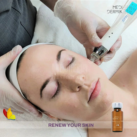 microneedling glutathione The Skin Sanctuary - From $100 - Rancho Santa Margarita main image 0
