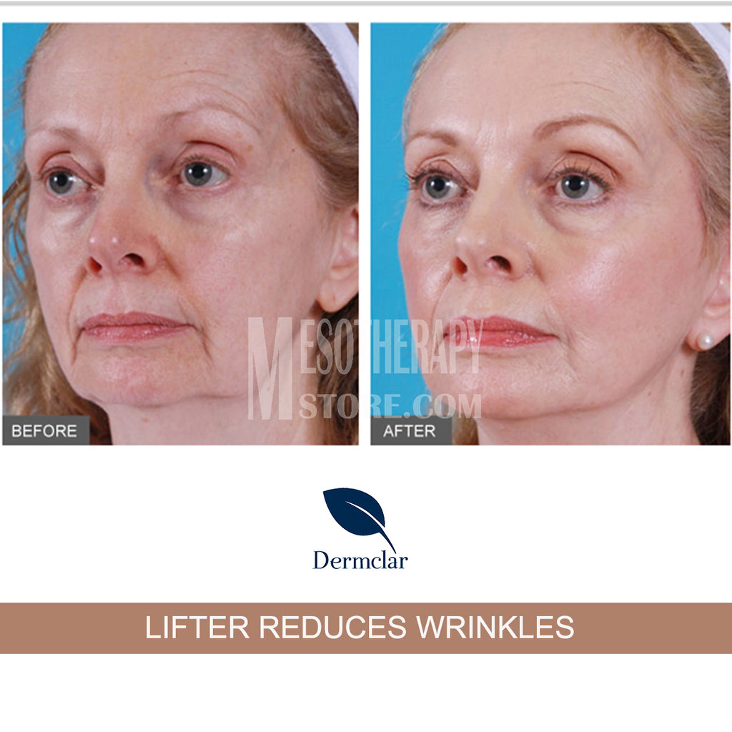 DMAE Lift Solution 3 (50ml) By Dermclar Mesotherapy Mesoterapia